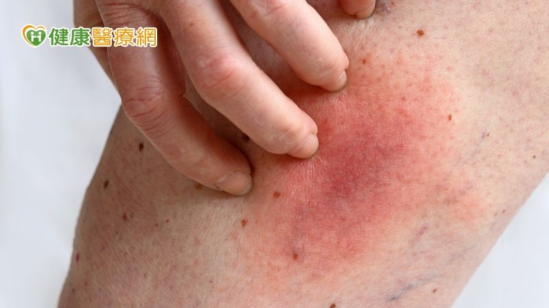 老婦摸到後腿腫塊 7天後「長大了」 化驗竟是惡性肉瘤