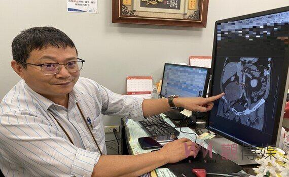 腳麻痛以為腰椎退化！竟是14公分巨大腫瘤作祟