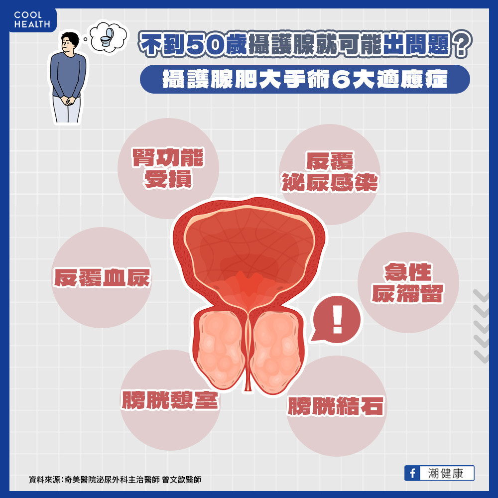 不到50歲就攝護腺肥大! 他每晚尿4次治療後回到20歲 不到50歲就攝護腺肥大! 他每晚尿4次治療後回到20歲