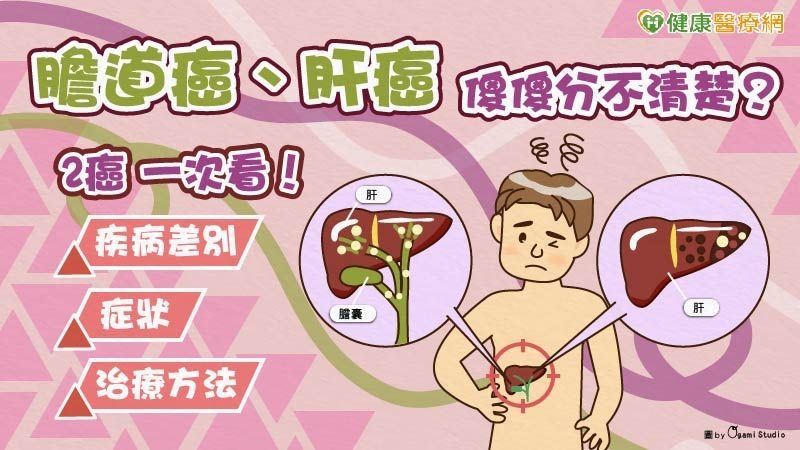 膽道癌、肝癌傻傻分不清楚?醫師帶你從腫瘤型態、症狀、治療了解! 