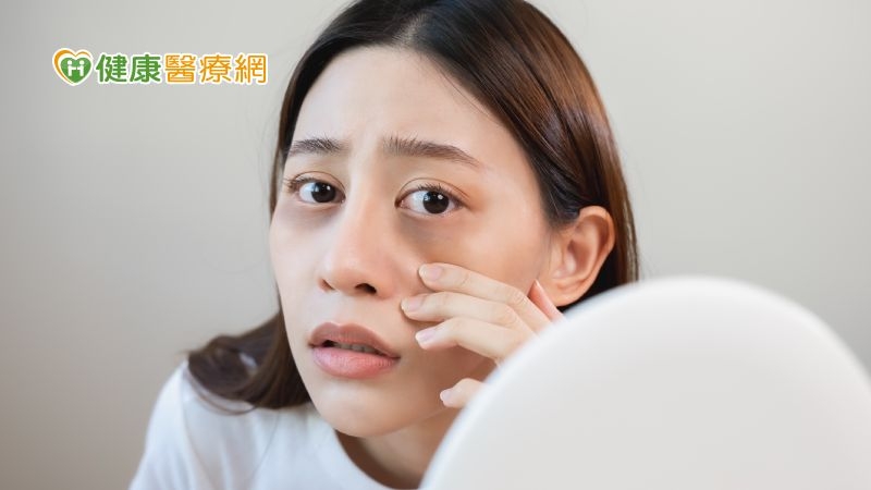 過年常有「這些」皮膚問題 醫師授保養小撇步!熬夜熬出黑眼圈也有解方