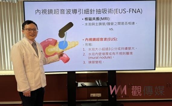 胰臟水泡是不是癌?臺中榮總:內視鏡超音波幫忙精準判斷