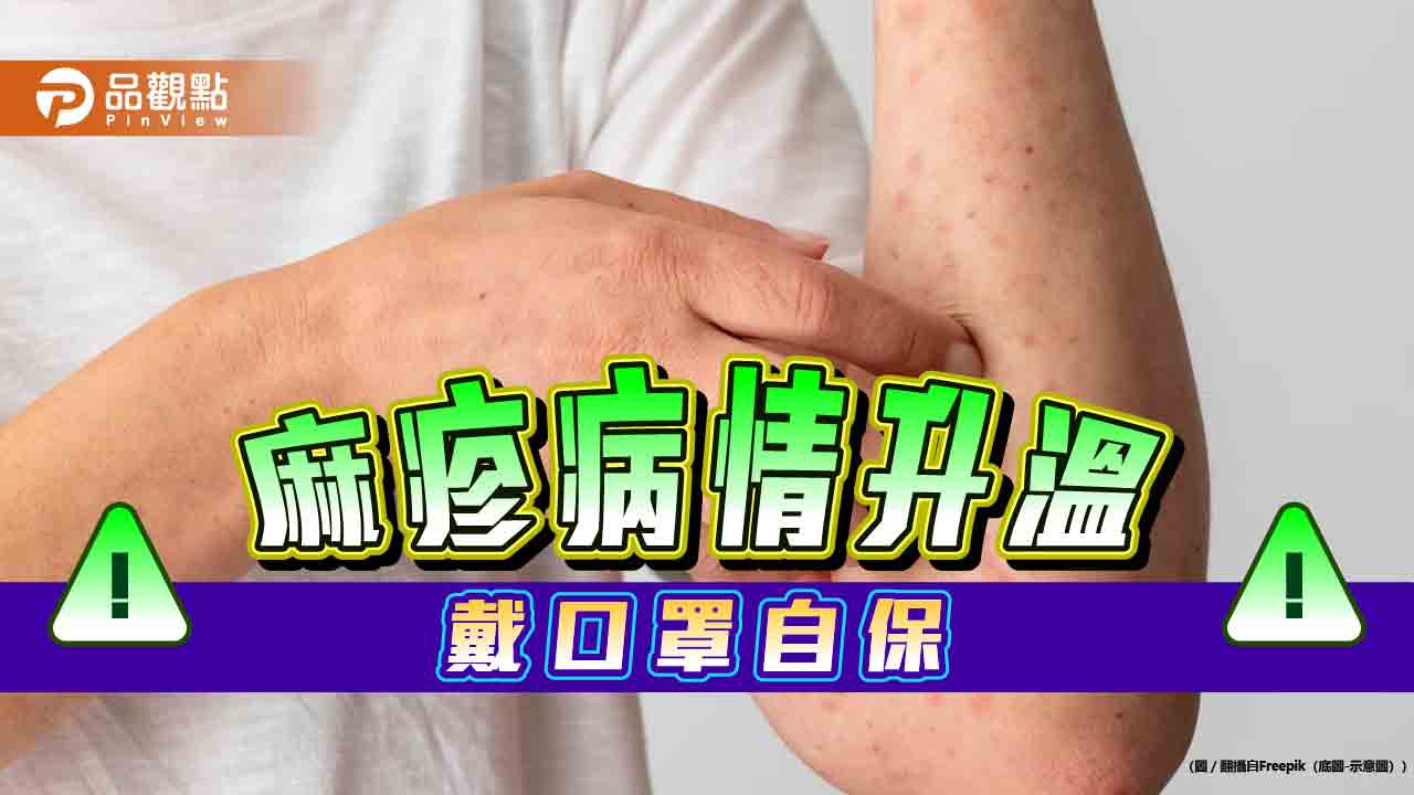 麻疹本土病情傳播快,戴口罩自保