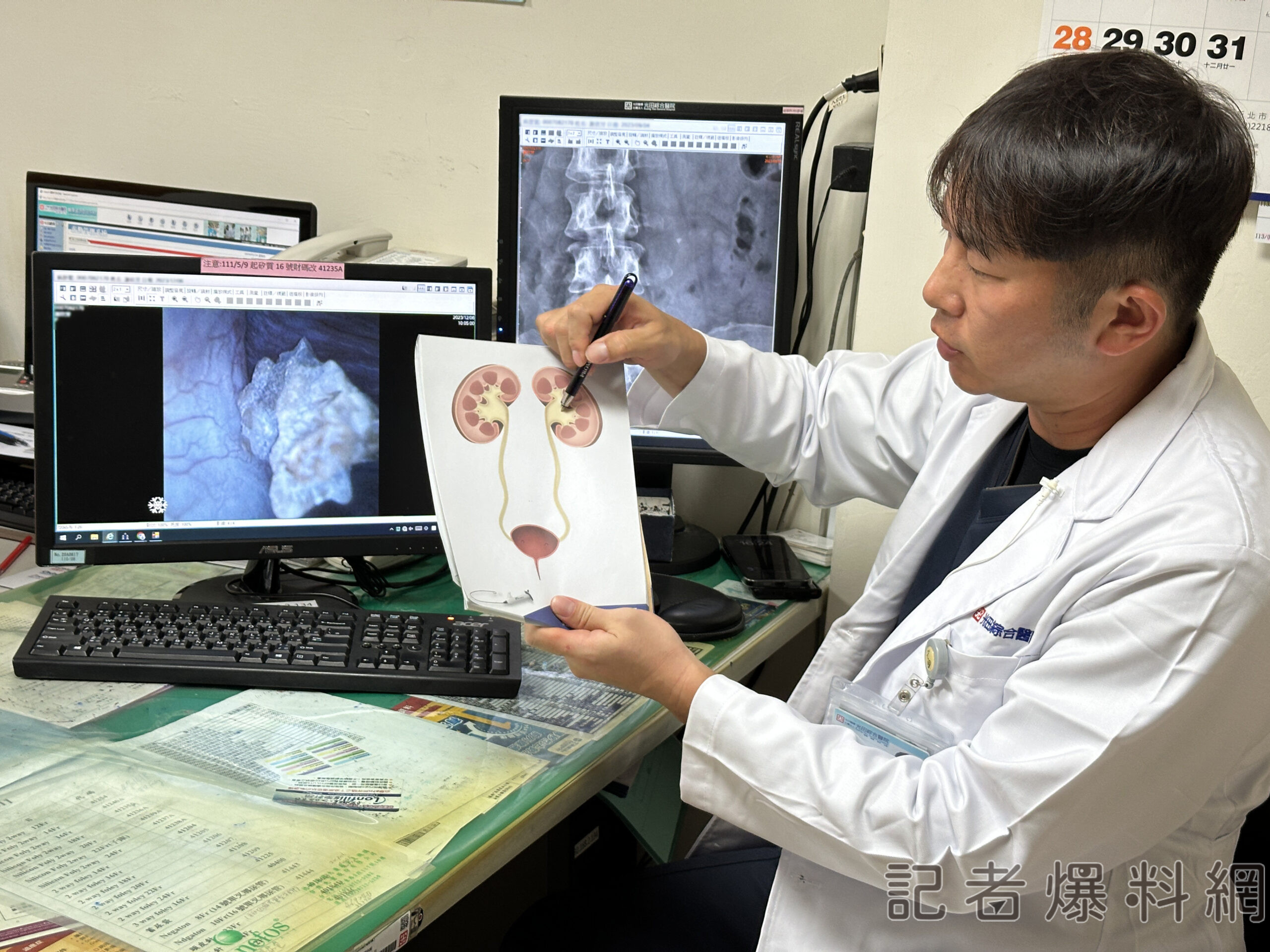 體內頑石反覆作怪痛不欲生 這手術讓她揪出凶手