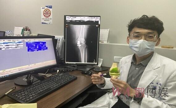 減少破壞性!人工膝關節翻修 取自體骨移植技術 患者重獲新生
