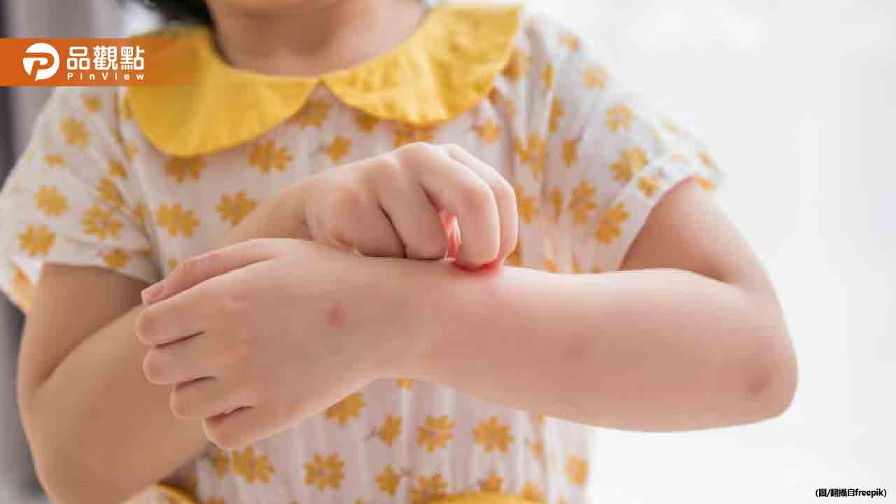 麻疹疫情升溫：強化預防措施與疫苗接種的必要性
