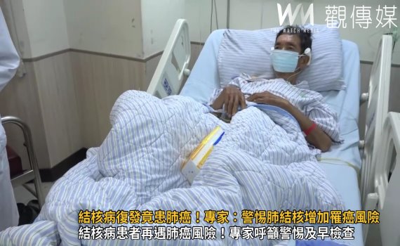 (有影片)/結核病復發竟患肺癌!專家:警惕肺結核增加罹癌風險
