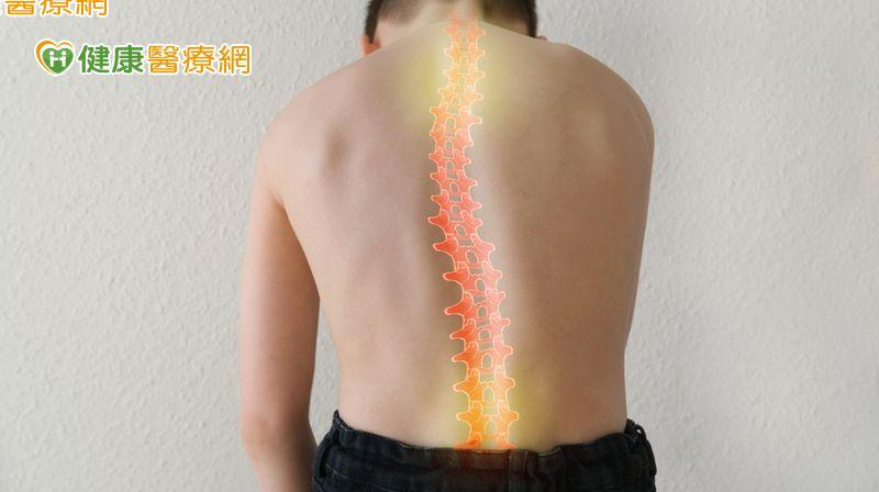 脊椎側彎中醫怎麼治療? 針灸、用藥、復健三管齊下