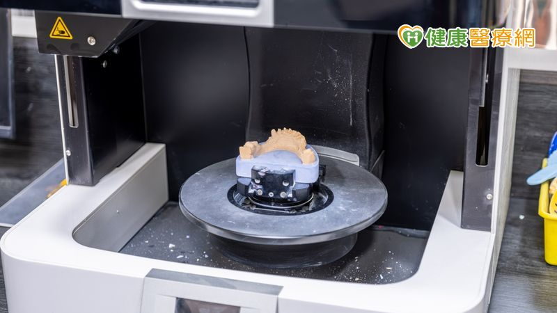 結合3D齒模列印技術 提升顏面骨傷手術品質