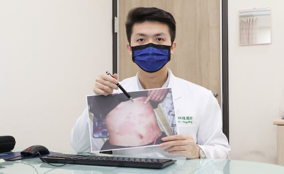 全身持續皮疹大發作 原來是甲狀腺有問題