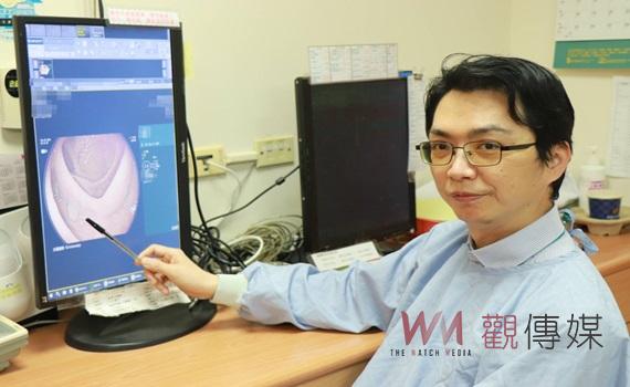 AI內視鏡檢查 大腸癌無所遁形
