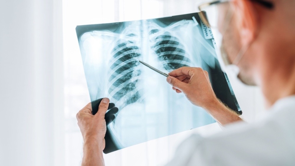 肺腺癌有無「腫瘤突變」決定患者命運? 醫呼籲:第一線「免疫+化療」應加速健保給付