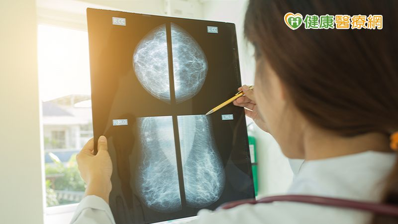 乳房有良性腫瘤要拿掉嗎?家族史有風險拿掉較好!