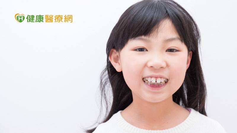 兒童口腔保健|牙齒立正站好! 掌握矯正時機&維持重點免砍掉重練