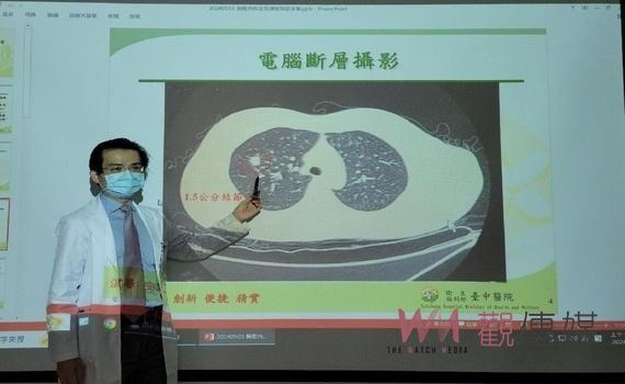 沒菸沒酒久咳不癒要小心! 確診後以為「長新冠」醫檢查竟是肺癌