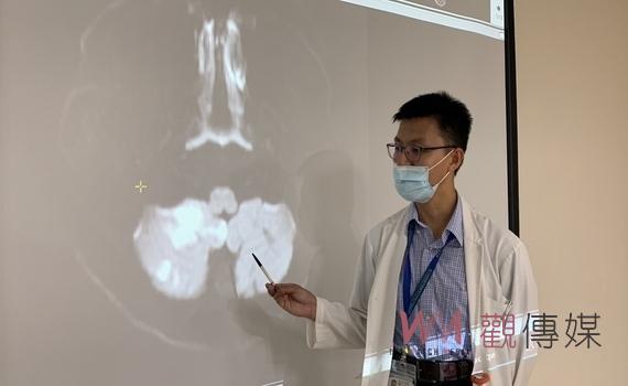 腦中風趨向年輕化!每週三次炸雞配手搖飲 壯男36歲梗塞性腦中風送醫