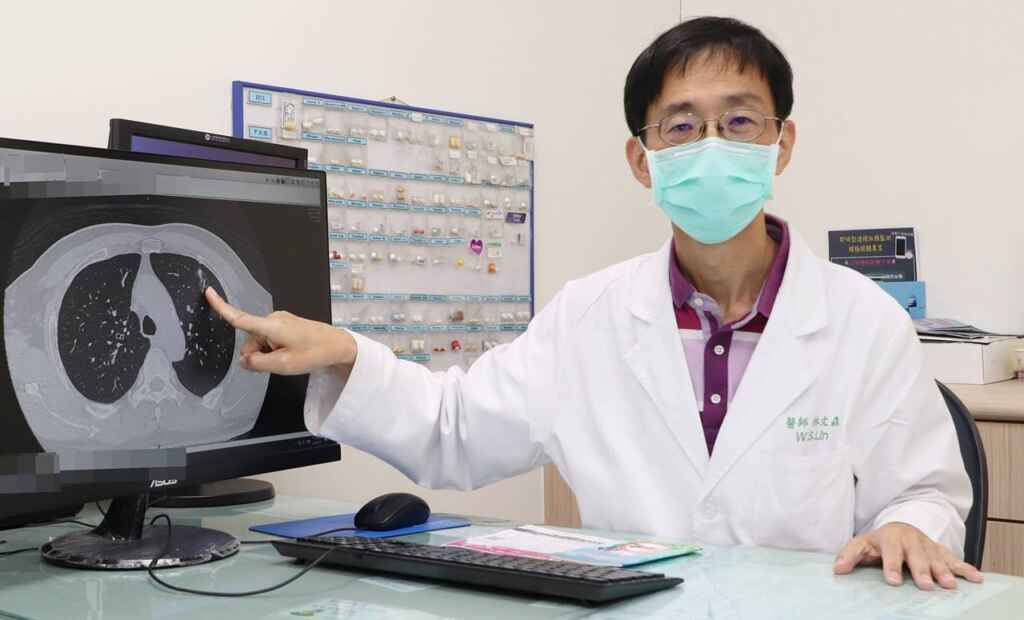 ▲仁愛長庚合作聯盟醫院內分泌暨新陳代謝科林文森主任指出,在病患左上肺葉發現肺結節,證實是肺腺癌並成功切除腫瘤。(仁愛長庚合作聯盟醫院提供)