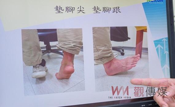 扁平足孩子健康成長隱形夥伴 成大提供全面評估與建議