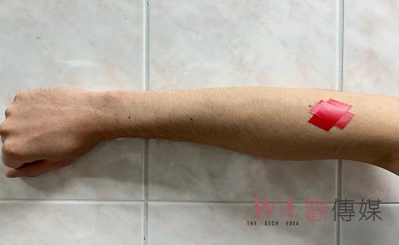 不一定打球才會得到「網球肘」! 治療師教您消滅不適感