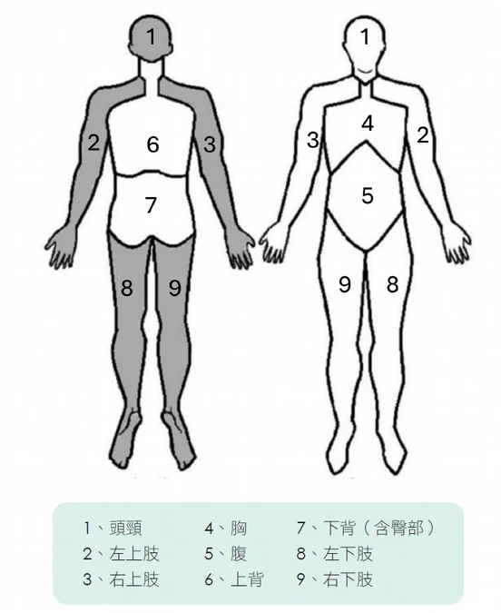纖維肌痛症的好發對象與診斷標準