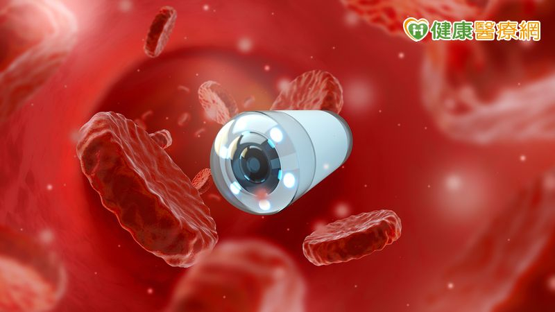 11歲男童突腹痛與血便,以為「食物中毒」! 膠囊內視鏡找出真兇