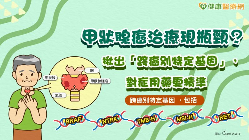 甲狀腺癌治療現瓶頸?揪出「跨癌別特定基因」,對症用藥更精準