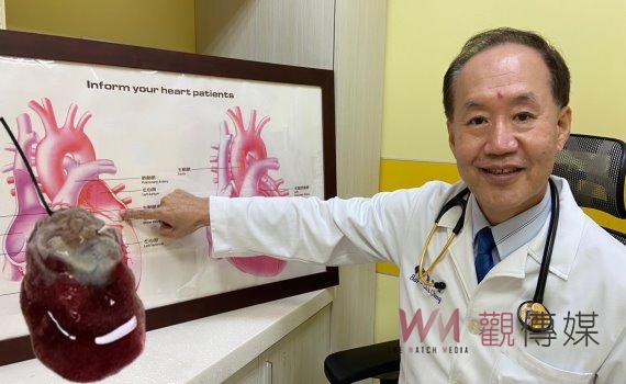 險中風 62歲婦人胃痛多年竟是心臟腫瘤 微創手術助其重獲新生