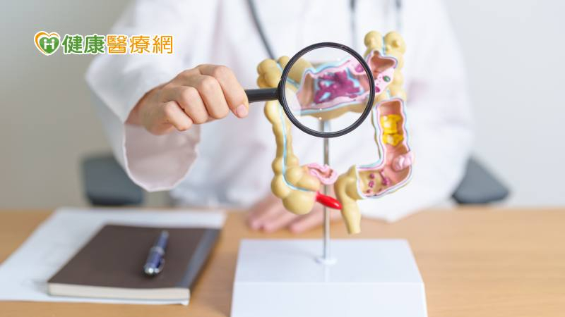 大腸癌篩檢正確步驟曝! 無血便也要篩?篩陽是痔瘡出血再篩1次就好?