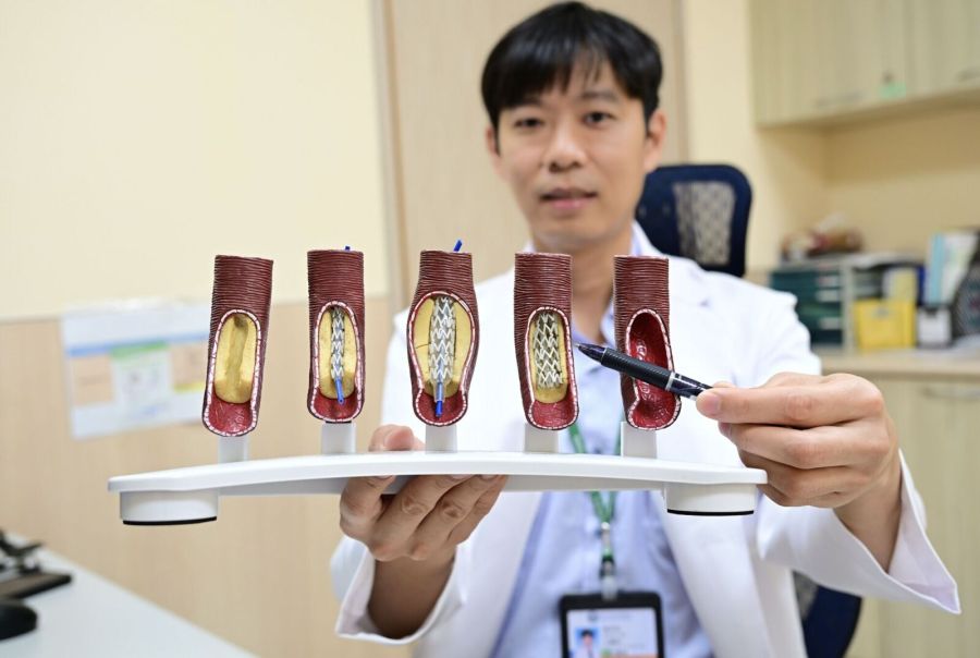 反覆胸痛跑急診找嘸病因 她心肌灌注掃描「動脈99%全塞住」 270 反覆胸痛跑急診找嘸病因 她心肌灌注掃描「動脈99%全塞住」 269