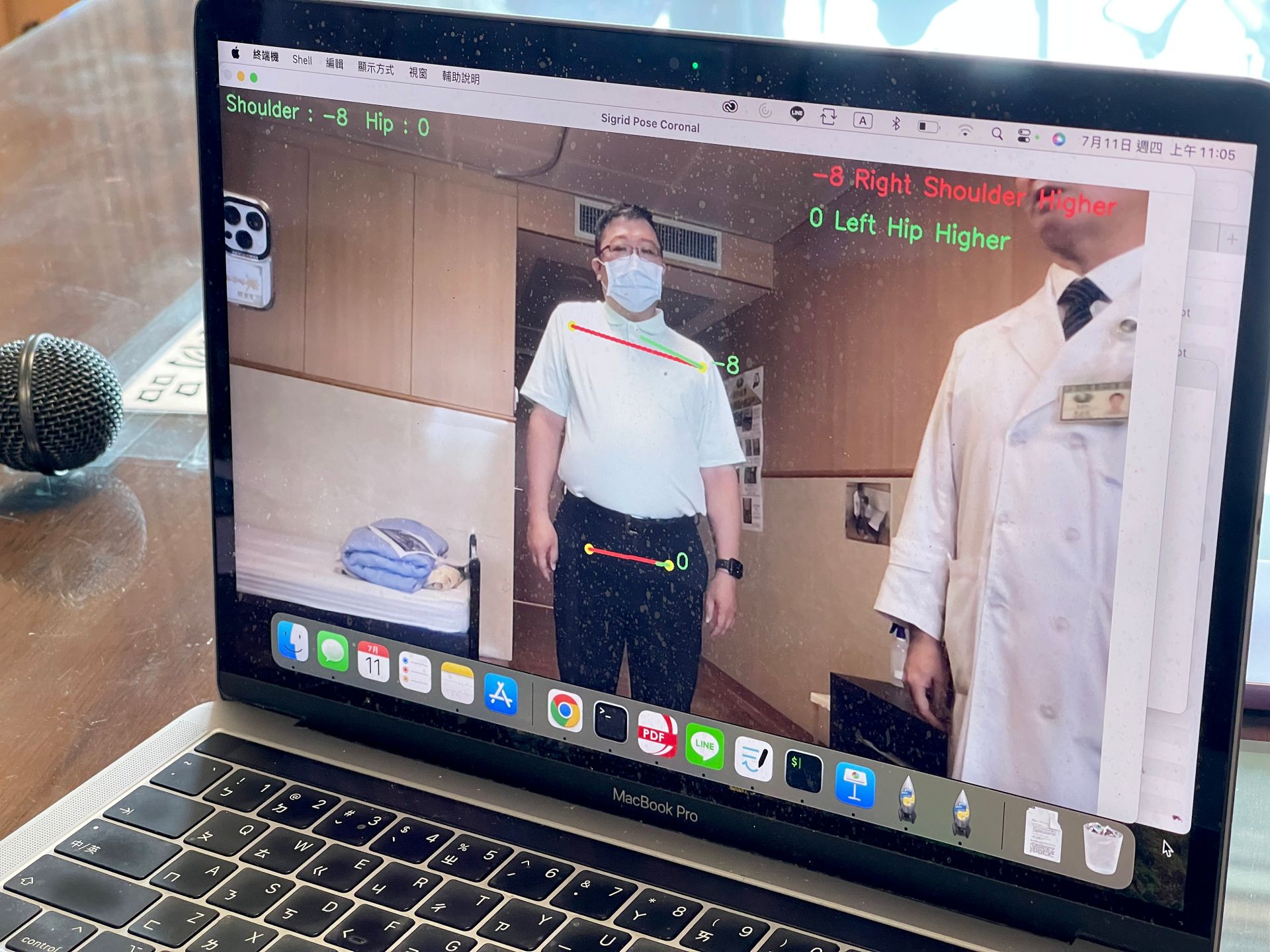 「AI智能關節偵測系統」透過姿勢變化的偵測,提供早期老化和肌少症風險的初步量化評估。