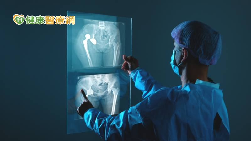 5分鐘解密骨質健康!亞東醫院「AI骨質疏鬆篩檢日」
