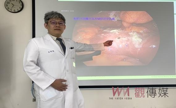 吃藥治療腕隧道症候群 造成腸胃道穿孔 醫提醒:注意止痛藥物之劑量與療程