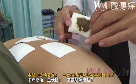 (有影片)/中醫「冬病夏治」 三伏貼療法助您改善慢性疾病