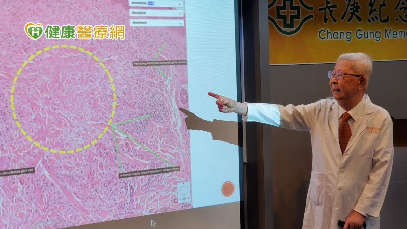 傳統病理玻片有「這些」保存問題! 長庚首建皮膚數位化全玻片影像系統