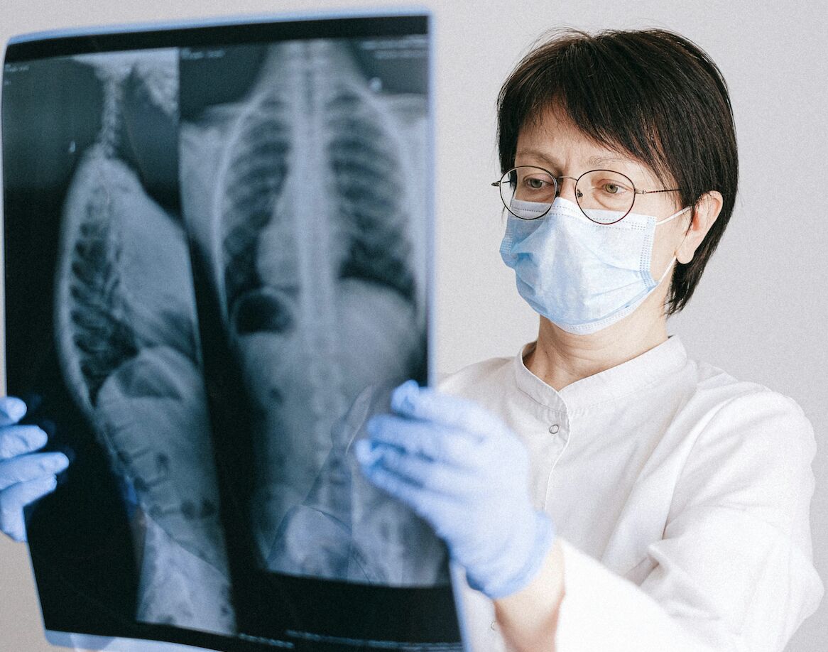 「不抽菸、遠油煙」照得肺癌? 醫師曝這些族群也要篩檢 286 「不抽菸、遠油煙」照得肺癌? 醫師曝這些族群也要篩檢 285