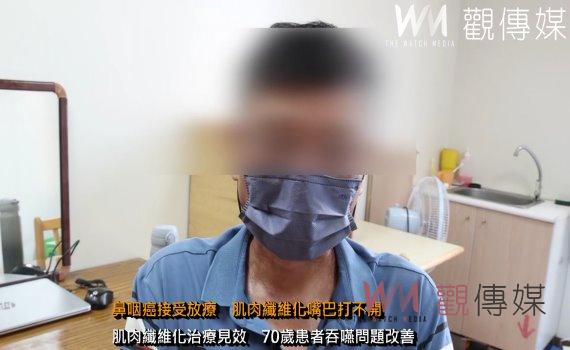 (有影片)/鼻咽癌接受放療 肌肉纖維化嘴巴打不開 割肉挖手臂來補