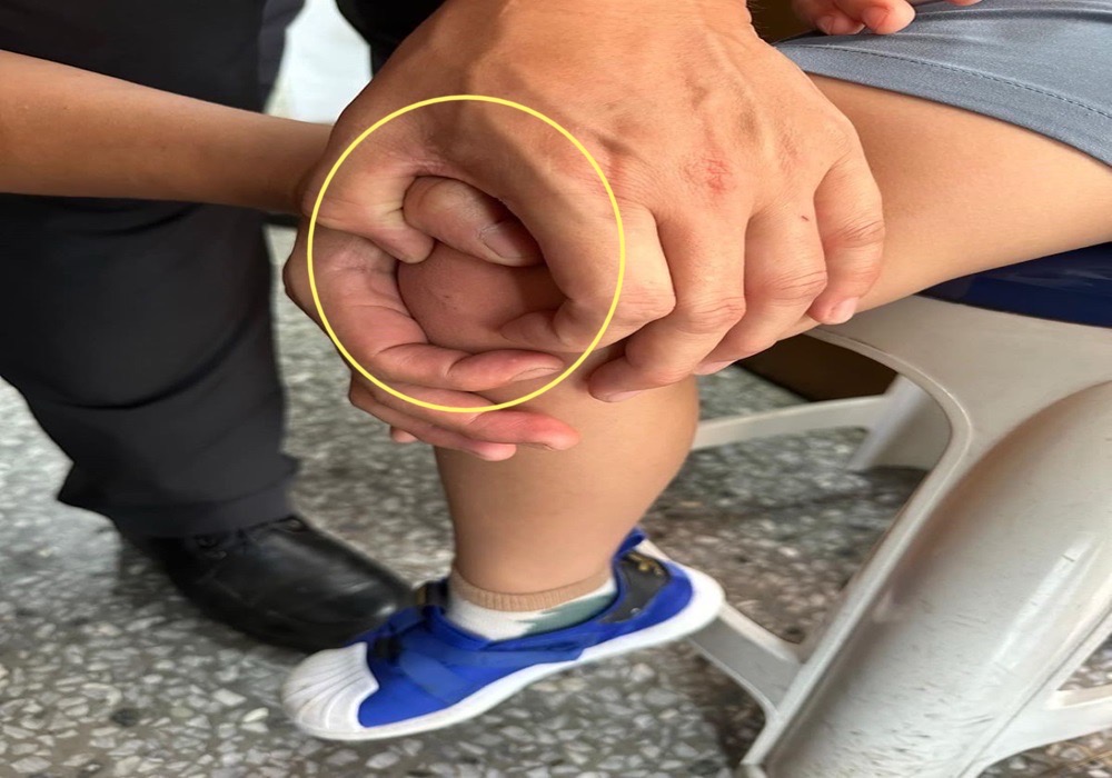 小男童蜜蜂螫傷 內湖警熱心協助就醫 245 248240813a07