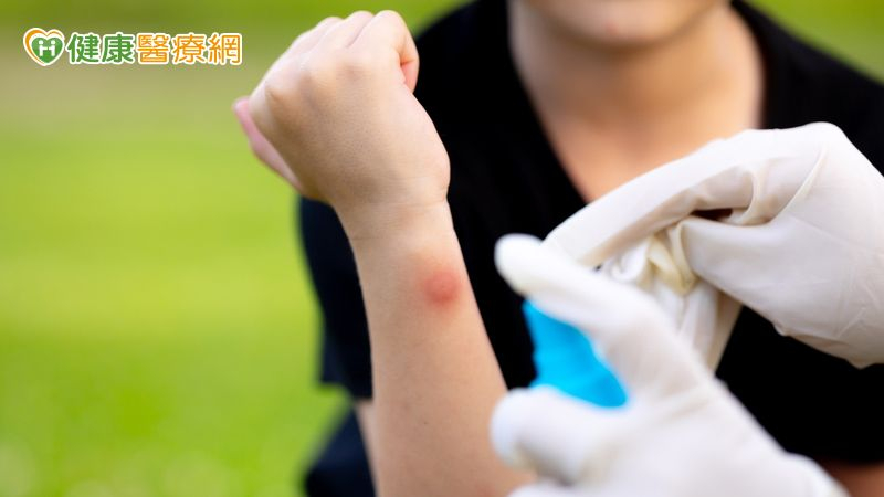 聰明使用防蚊液!塗抹部位、時間、順序各不同!