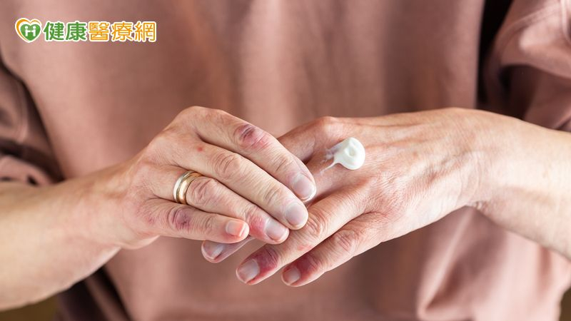 富貴手好煩惱!如何正確使用護手霜及藥膏?