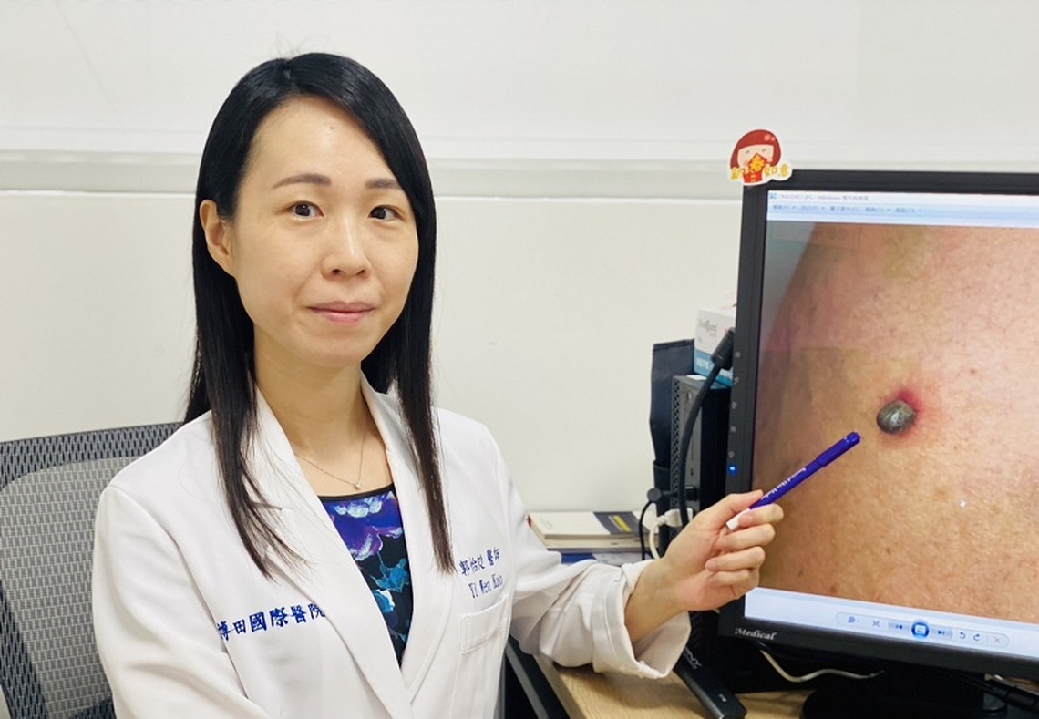 老翁遊日小腿冒息肉 就醫才知蜱蟲跟回台