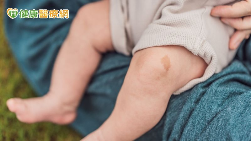 出生異常複雜「血管瘤」　11歲女童恢復行動、融入同儕