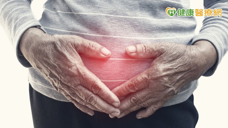 75歲婦罹第三期腎盂泌尿上皮癌 「立體定位放射治療」保留腎臟、抗癌有成