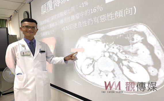 巨大腫瘤阻塞腸道以為是癌　臺中醫院檢查：發現是這個免疫系統疾病造成