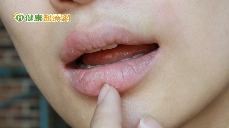 口乾不一定是水喝不夠! 可能與「這些」疾病有關