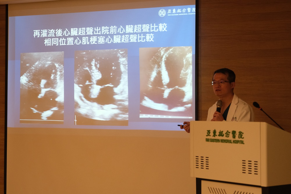 心臟超飽和氧治療 亞東醫院:降低心肌梗塞死亡率 232 cnews204240905a08jpg