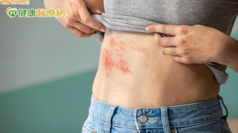 最新研究:每次帶狀皰疹發作「認知能力」下降20% 接種疫苗刻不容緩