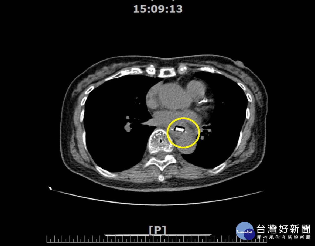 幼兒或長輩服藥一定要小心。（南投醫院提供）
