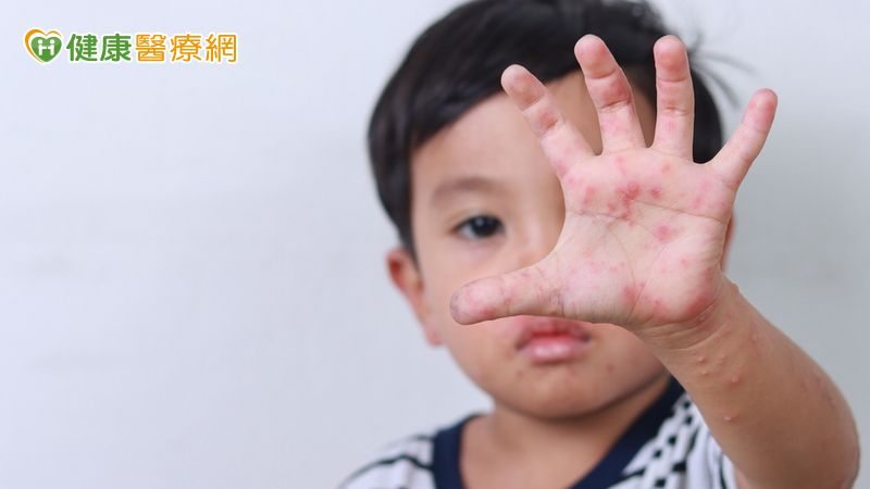 腸病毒也跟著開學!醫:A71型重症率高 家長務必留意7大重症前兆