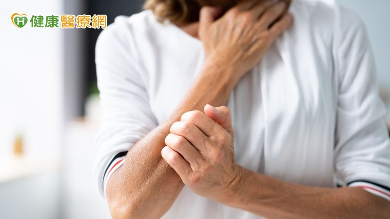 異位性皮膚炎如何避免減輕不適、避免惡化? 新型治療抑制中、重度發炎反應