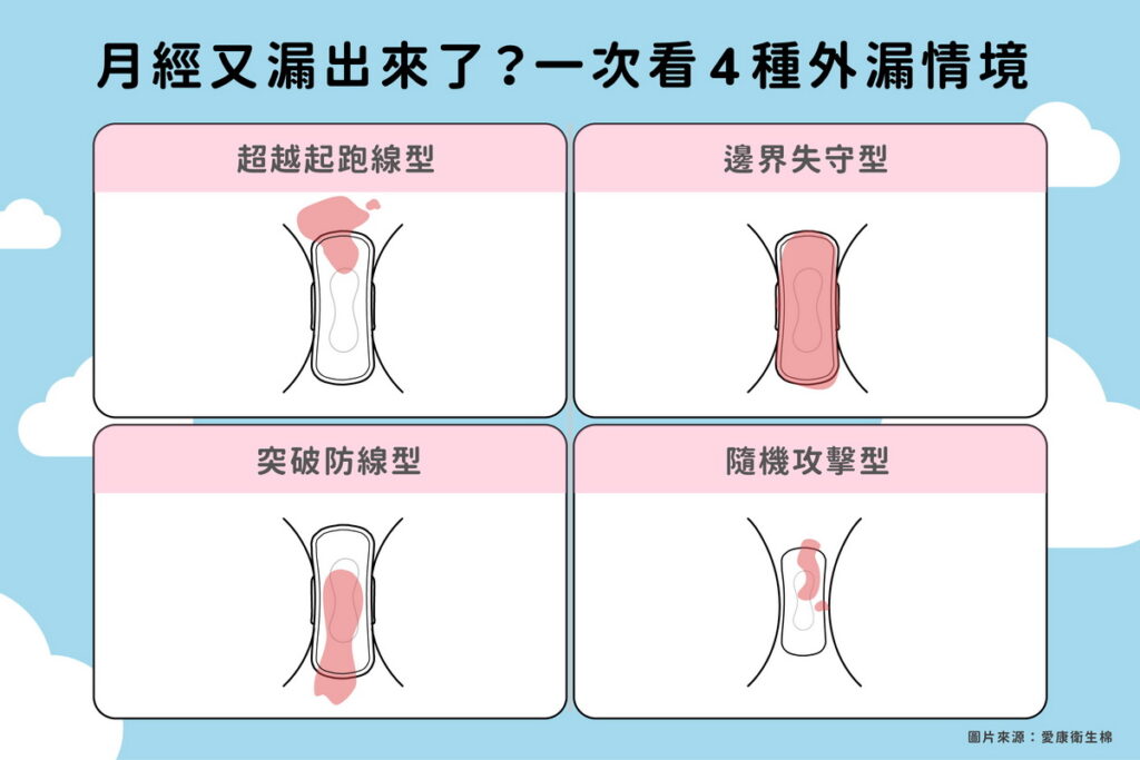 愛康列出4種常見外漏情境,並分享應對的防漏妙招。(圖片來源:愛康衛生棉)